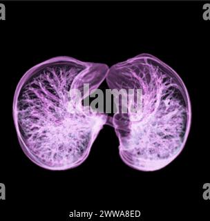 CT-3D-Darstellung von Brust oder Lunge mit Trachea und Lunge im Respirationssystem. Stockfoto