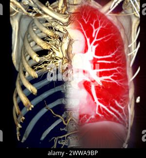 CTA 3D-Rendering der thorakalen Aorta bietet eine detaillierte Visualisierung und liefert klare Einblicke in die Anatomie, Pathologie und die umgebenden Strukturen der Aorten für Stockfoto