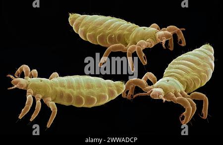 Kopfläuse. Farbige Rasterelektronenmikrographie (REM) von Kopfläusen (Pediculus humanus capitis). Vergrößerung: 10 x, wenn 10 cm breit gedruckt. Stockfoto