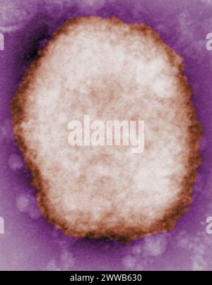 Stark vergrößertes negativ-Fleck-Transmissions-Elektronenmikrogramm (TEM) Bild, das ein Typ M Monkeypox Virus oder Maulbeere enthüllt. Stockfoto