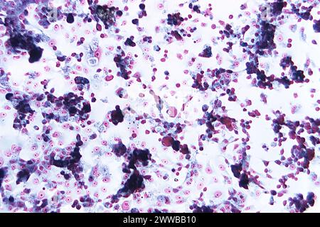 Unter 125-facher Vergrößerung zeigte dieser 1973er-Photomikrograph einer trichromgefärbten Probe menschlichen Hirngewebes das Vorhandensein von Naegleria gruberi. Stockfoto