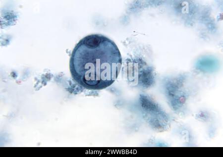 Unter 1150-facher Vergrößerung zeigte dieser Photomikrograph eines trichromen Präparats das Vorhandensein einer unreifen, parasitären, binukleären Zyste. Stockfoto