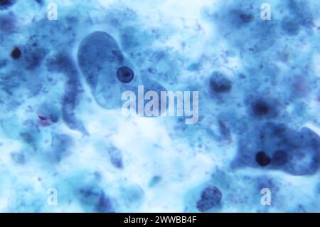 Unter 1150-facher Vergrößerung zeigte dieser Photomikrograph einer trichromgefärbten Probe das Vorhandensein parasitärer Entamoeba coli-Trophozoiten. CDC/Dr. Stockfoto