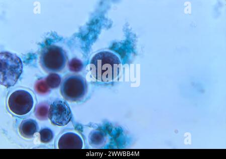 Dieser Photomikrograph einer trichromgefärbten Gewebeprobe zeigte das Vorhandensein einer Zyste einer Vermamoeba vermiformis. Stockfoto