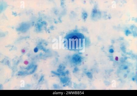 Dieser trichromgefärbte Photomikrograph zeigte das Vorhandensein eines Entamoeba hartmanni-Trophozoiten, der seinen charakteristischen Einzelkern zeigte. Stockfoto