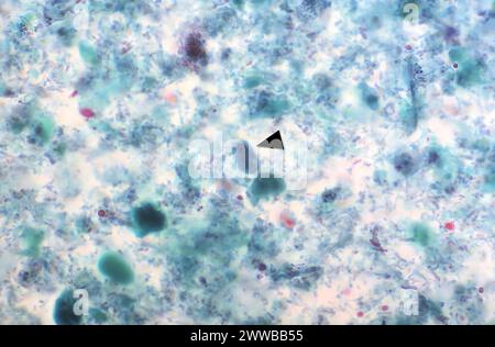 Diese Photomikrographie eines trichromgefärbten Exemplars zeigte das Vorhandensein eines Entamoeba hartmanni-Trophozoiten (Pfeil). E. Stockfoto