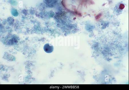 Diese Photomikrographie eines trichromen Exemplars zeigte jedoch das Vorhandensein eines parasitären Trophozoiten Iodamoeba butschlii (buetschlii). Stockfoto
