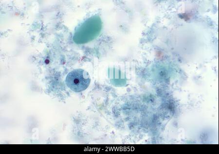 Diese Photomikrographie eines trichromen Exemplars zeigte jedoch das Vorhandensein eines parasitären Trophozoiten Iodamoeba butschlii (buetschlii). Stockfoto