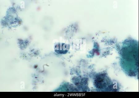 Diese Photomikrographie eines trichromen Exemplars zeigte das Vorhandensein eines parasitären Trophozoiten, Iodamoeba butschlii (buetschlii). Stockfoto