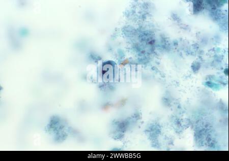 Diese Photomikrographie eines trichromen Exemplars zeigte das Vorhandensein eines parasitären Trophozoiten, Iodamoeba butschlii (buetschlii). Stockfoto