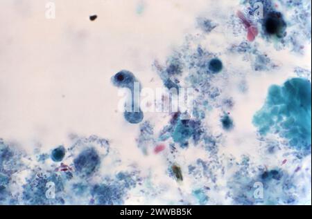 Diese Photomikrographie eines trichromen Exemplars zeigte das Vorhandensein eines langgestreckten, parasitären Iodamoeba butschlii (buetschlii) Trophozoiten. Stockfoto