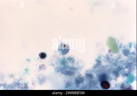 Diese Photomikrographie eines trichromen Exemplars zeigte das Vorhandensein eines parasitären Trophozoiten, Iodamoeba butschlii (buetschlii). Stockfoto