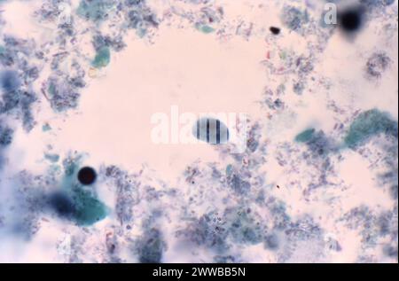 Diese Photomikrographie eines trichromen Exemplars zeigte das Vorhandensein eines parasitären Trophozoiten, Iodamoeba butschlii (buetschlii). Stockfoto