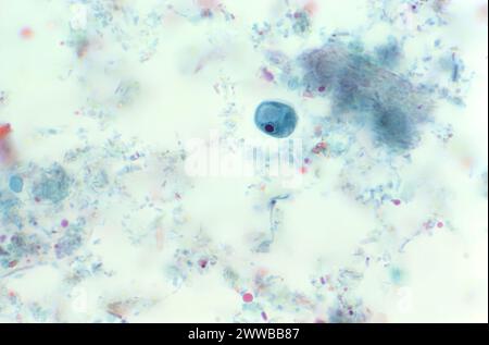 Dieser Photomikrograph einer trichromen Probe zeigte eine einzelne Iodamoeba butschlii (buetschlii) parasitische Zyste. Stockfoto