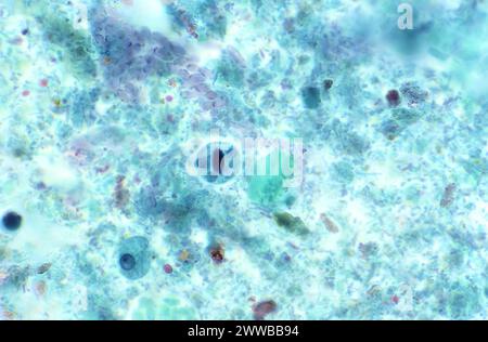 Dieser trichromgefärbte Photomikrograph zeigte einige der ultrastrukturellen Merkmale eines parasitären Organismus, der als Entamoeba histolytica bekannt ist. Stockfoto
