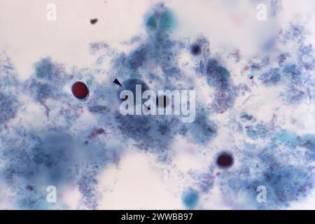 Dieser Photomikrograph eines trichromen Präparats zeigte eine einzelne Iodamoeba btschlii ( buetschlii ) parasitäre Zyste. Stockfoto