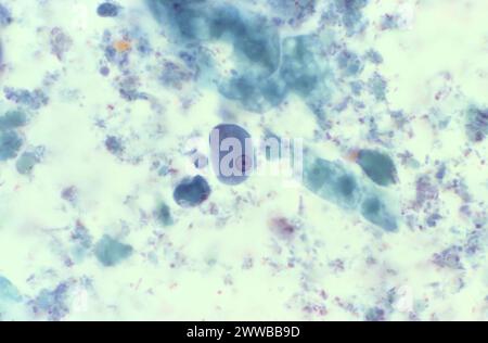 Dieser trichromgefärbte Photomikrograph zeigte einige der ultrastrukturellen Merkmale eines parasitären Organismus, der als Entamoeba histolytica bekannt ist. Stockfoto