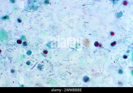 Dieser Photomikrograph zeigte einen leicht trichromgefärbten, nicht-kernhaltigen, parasitären Trophozoiten von Dientamoeba fragilis in diesem Exemplar. Stockfoto
