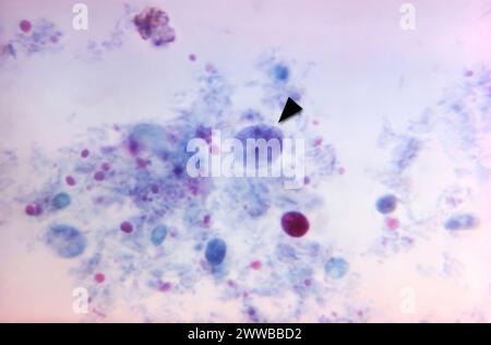 Dieser Photomikrograph zeigte das Vorhandensein eines binukleären parasitären Trophozoiten von Dientamoeba fragilis, gefärbt mit Trichrom. Stockfoto