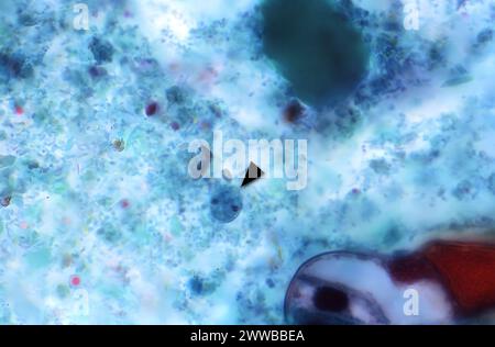 Dieser Photomikrograph zeigte ein gutes Beispiel für einen zweikernigen parasitären Trophozoiten von Dientamoeba fragilis, der mit Trichrom gefärbt wurde. Stockfoto
