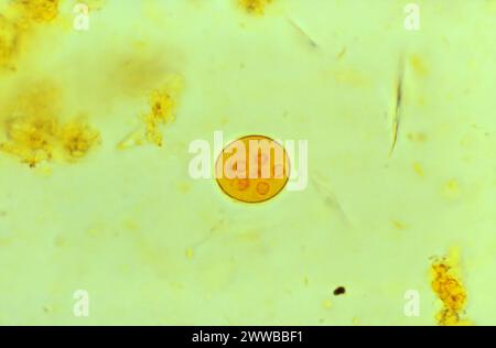 Dieser Photomikrograph einer jodgefärbten Probe zeigte die ultrastrukturelle Morphologie einer einzelnen Entamoeba coli-Parasitenzyste. Stockfoto