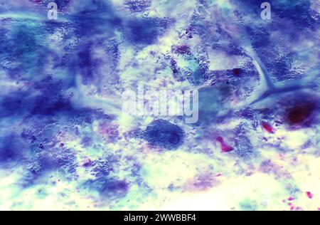 Diese Photomikrographie eines mit Wheatleys-Trichromen gefärbten Exemplars zeigte das Vorhandensein eines parasitären Trophozoiten, Entamoeba histolytica. Stockfoto