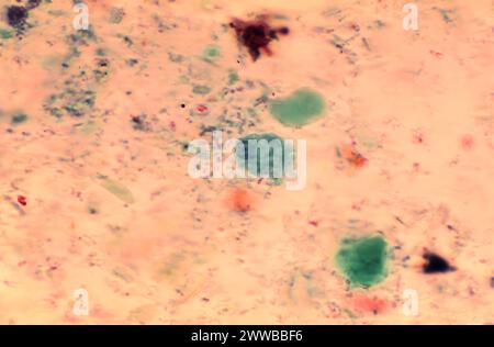 Diese Photomikrographie eines mit Wheatleys-Trichromen gefärbten Exemplars zeigte das Vorhandensein eines parasitären Trophozoiten, Entamoeba histolytica. Stockfoto