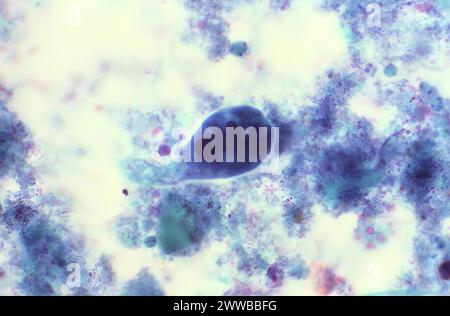 Diese Photomikrographie eines trichromen Präparats zeigte das Vorhandensein eines Entamoeba coli-Trophozoiten. Stockfoto