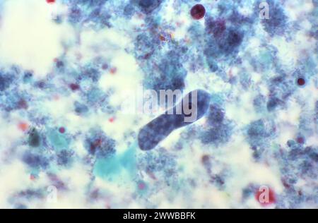 Diese Photomikrographie eines trichromgefärbten Exemplars zeigte das Vorhandensein eines typischen Entamoeba coli-Trophozoiten. Stockfoto