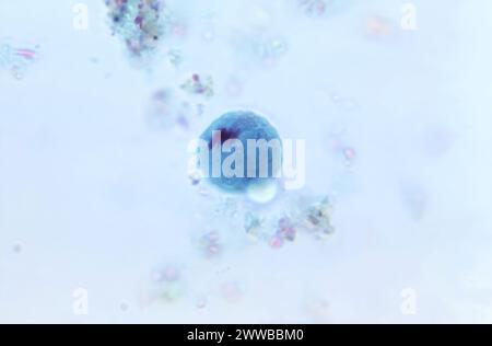 Dieser Photomikrograph einer trichromgefärbten Stuhlprobe zeigte das Vorhandensein dieser Entamoeba coli-Zyste. Stockfoto