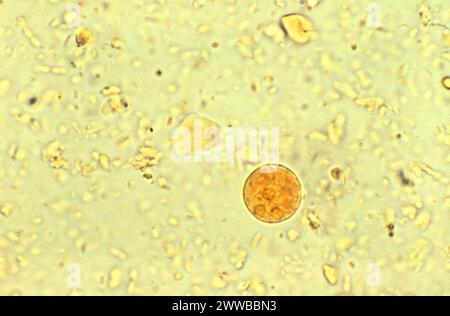 Dieser jodgefärbte Photomikrograph zeigte das Vorhandensein einer Amoeba histolytica-Amoeba-Parasitenzyste. Stockfoto