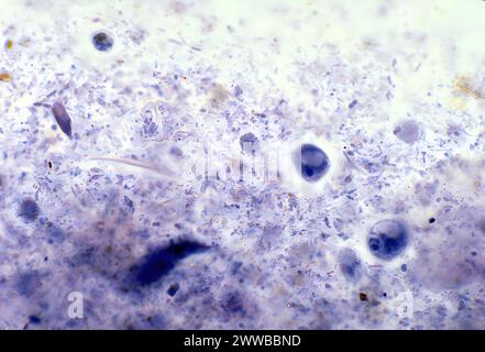 Dieser Photomikrograph zeigt eine Reihe von Zysten des Amöbenparasiten Iodamoeba butschlii (buetschlii). Stockfoto