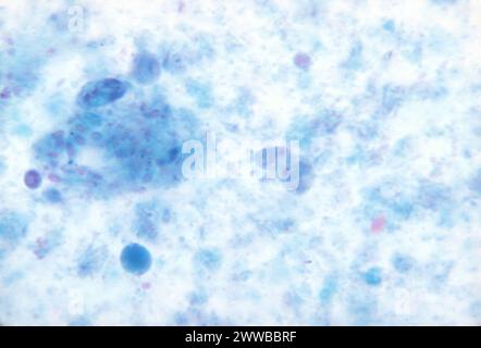 Dieser Photomikrograph zeigte das Vorhandensein trichromgefärbter parasitärer Dientamoeba fragilis-Trophozoiten in dieser Probe. CDC 1970. Stockfoto