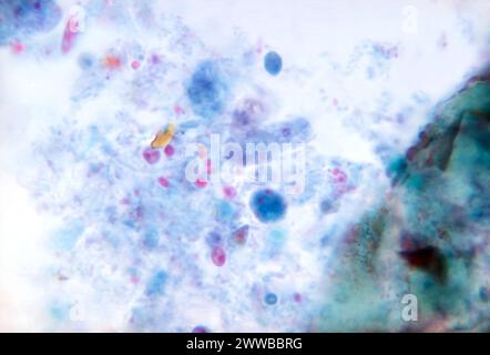 Dieser Photomikrograph zeigte das Vorhandensein eines trichromen parasitären Trophozoiten Dientamoeba fragilis in dieser Probe. CDC 1970. Stockfoto