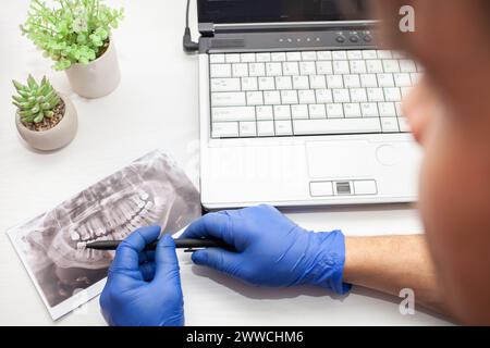 Der Zahnarzt in der Klinik untersucht das Röntgenbild des Kiefers der Zähne des Patienten. Moderne Technologien. Stockfoto