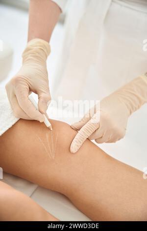 Cosmetologe markierte weibliche Knie, wird ein Fadenlifting durchführen Stockfoto