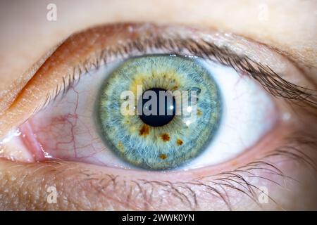 Beschreibung: Weibliches blau-grünes Auge mit braunen Pigmentflecken. Pupille Geöffnet. Nahaufnahme. Strukturelle Anatomie. Makrodetails Für Menschliche Blende. Stockfoto