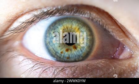 Beschreibung: Weibliches blau-grünes Auge mit braunen Pigmentflecken. Pupille Geschlossen. Nahaufnahme. Strukturelle Anatomie. Makrodetails Für Menschliche Blende. Stockfoto