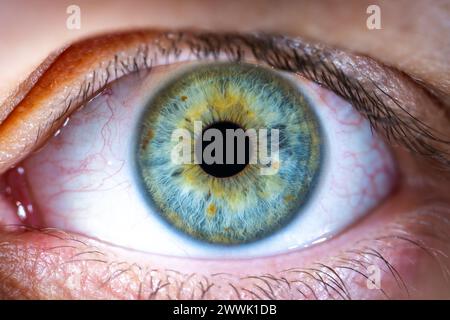 Beschreibung: Weibliches blau-grünes Auge mit braunen Pigmentflecken. Pupille Geöffnet. Nahaufnahme. Strukturelle Anatomie. Makrodetails Für Menschliche Blende. Stockfoto