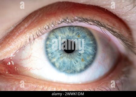 Beschreibung: Männliches blaues Auge mit gelben Pigmentflecken und Wimpern. Pupille Geöffnet. Nahaufnahme. Strukturelle Anatomie. Makrodetails Für Menschliche Blende. Stockfoto