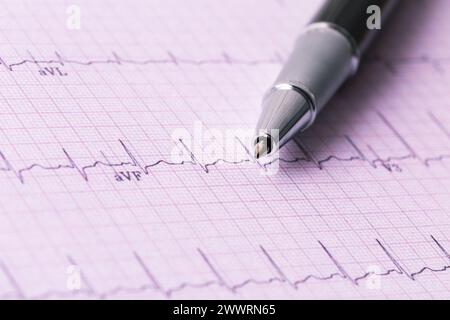 Kardiogramm und technischer Stift Stockfoto