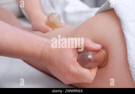 Der Masseur massiert mit Gläsern Cellulite auf dem Gesäß und den Oberschenkeln des Patienten. Behandlung des Übergewichts. Stockfoto