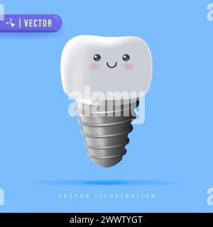 Dentale Implantatvektorillustration. Orthopädische Behandlung Moderne Methode. Vektor Stomatologische Illustration isoliert auf Blau. Stock Vektor