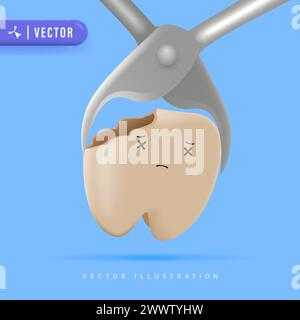 3D-Vektor-Illustration für realistische Zahnextraktion. Zahnbehandlung und Zahnpflegekonzept. Stock Vektor