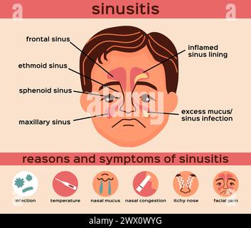 Flache Infografik-Layout mit Gründen und Symptomen der Sinusitis-Vektorillustration Stock Vektor