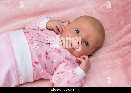 Das Baby liegt auf dem Bett und hat Allergien, Hautausschläge im Gesicht des Neugeborenen Stockfoto