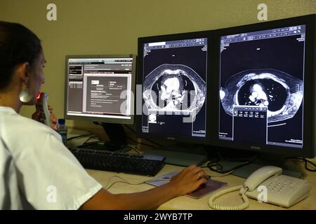 Abdominopelvic CT Scan, Radiologie Interpretation Review, Radiologie Abteilung, Donostia Hospital, San Sebastian, Donostia, Gipuzkoa, Baskenland, Spanien. Stockfoto