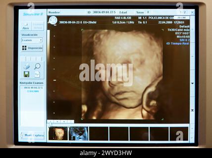 3D geburtshilflicher Ultraschall eines Fetus, 4D Baby Scan zeigt Bewegung, Gynäkologie, Krankenhaus Policlinica Gipuzkoa, San Sebastian, Donostia, Euskadi, Spanien. Stockfoto