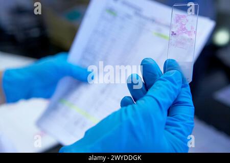 Gewebeprobe, pathologische Anatomie. Krankenhaus Universitario Gran Canaria Arzt Negrin, Las Palmas de Gran Canaria. Kanarische Inseln, Spanien. Stockfoto