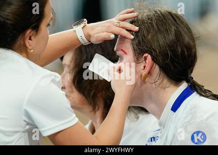 Heidelberg, Deutschland. April 2024. Handball, Frauen: Qualifikation zur Europameisterschaft, Israel - Deutschland, 1. Runde, Gruppe 2, Spieltag 2, SNP-Dome. Die israelische Anna Lezinska wird wegen einer Augenverletzung behandelt. Quelle: Uwe Anspach/dpa/Alamy Live News Stockfoto